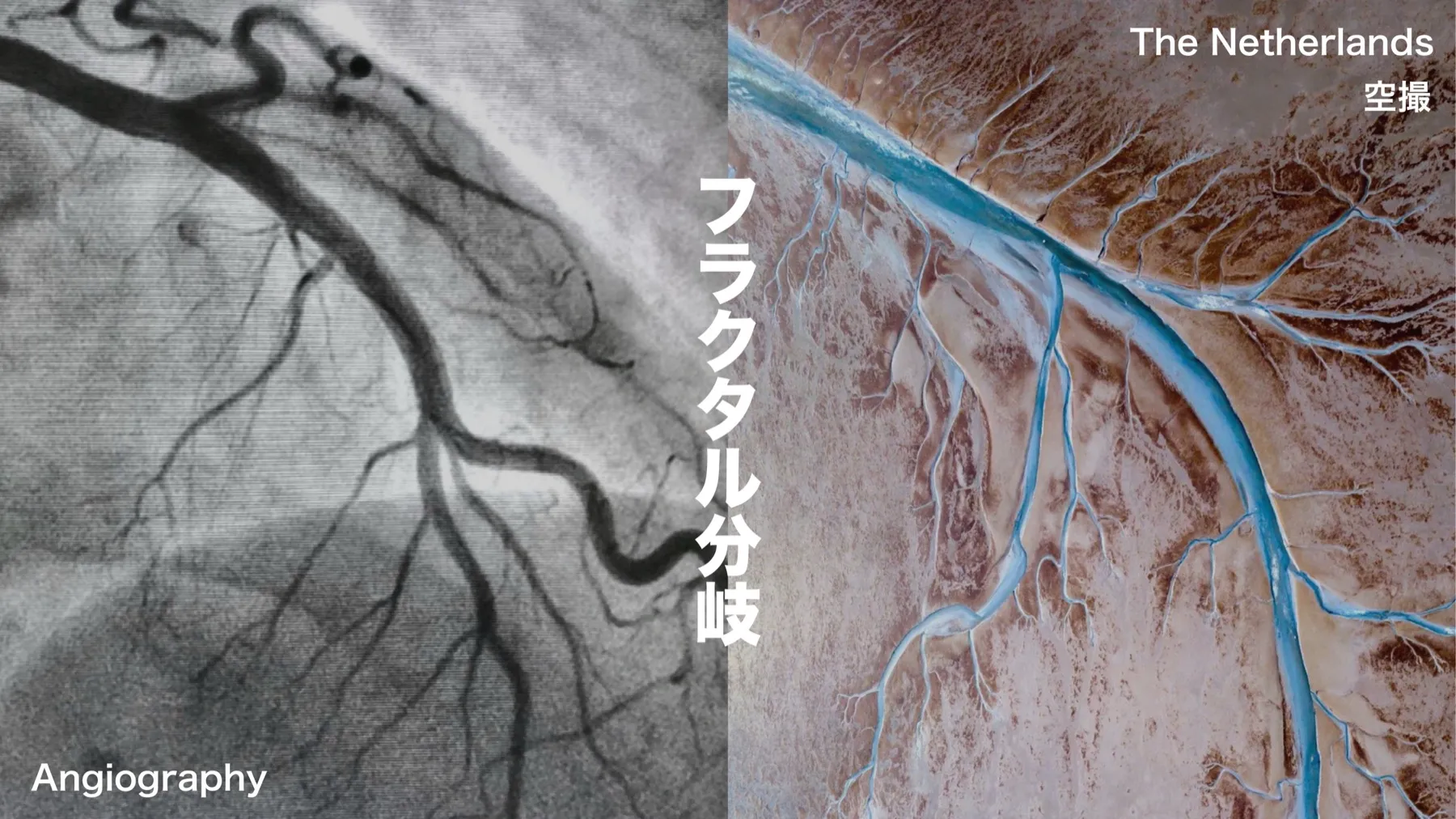 左は心臓の冠動脈を示す画像、右は大地を蛇行する川を上空から見た画像。中央に「フラクタル分岐」の文字。どちらも太い流れから細い流れへ、同じように枝分かれしている